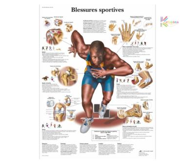Planche anatomique - Blessures sportives